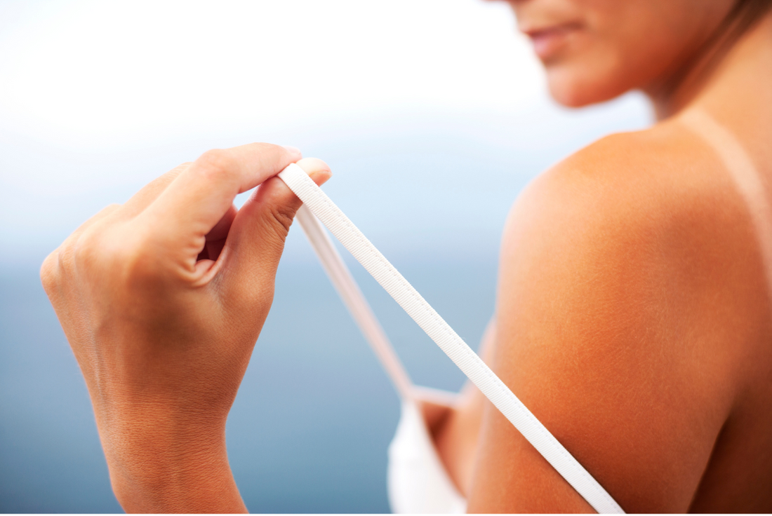 Red skin after tanning? 4 beauty tricks Part 2
